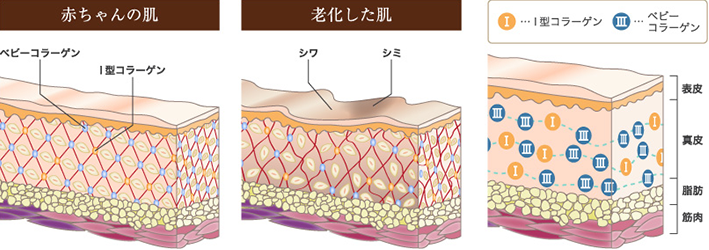 赤ちゃんの肌 老化した肌 I型コラーゲン ベビーコラーゲン